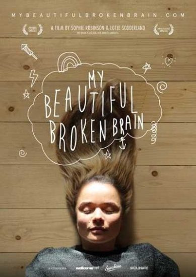 فيلم My Beautiful Broken Brain 2014 مترجم